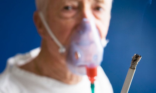 Ho đờm ở người hút thuốc: Nguy cơ COPD tiềm ẩn